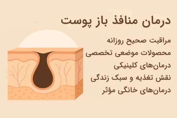 درمان منافذ باز پوست