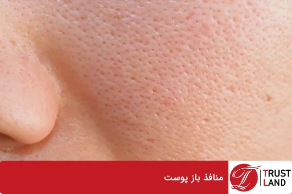 منافذ باز پوست